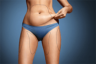 CoolSculpting-stubborn-fat